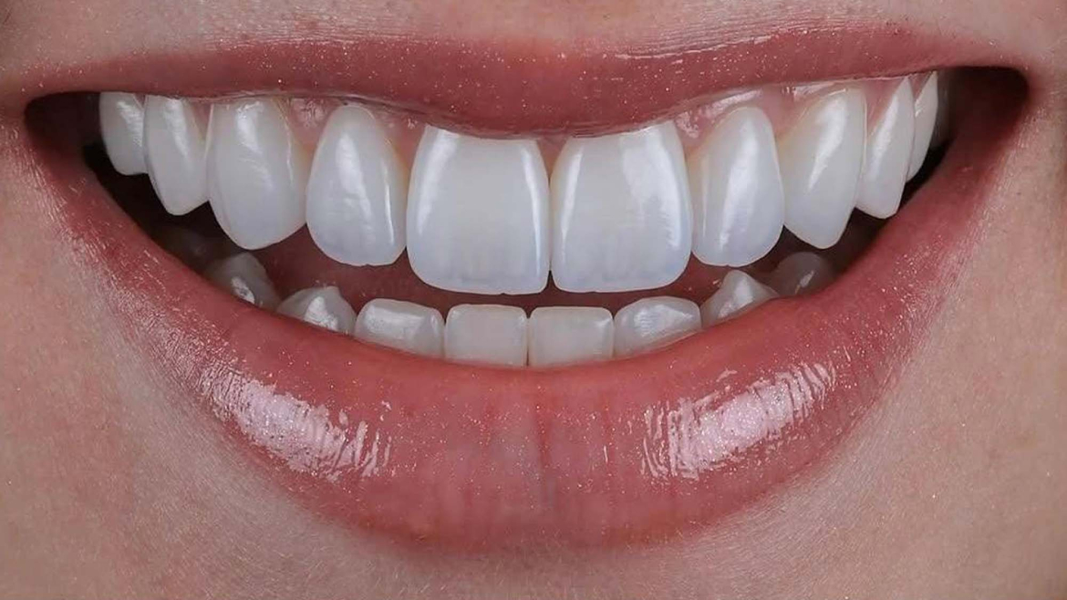 Cosmetic Dentistry