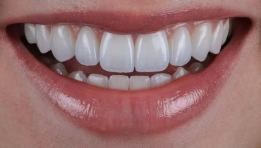 Cosmetic Dentistry