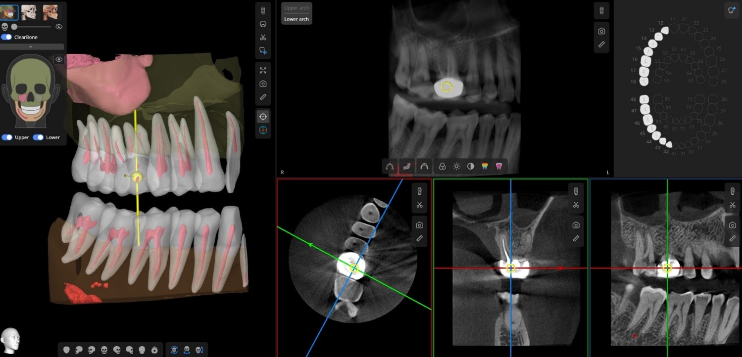 5D CBCT