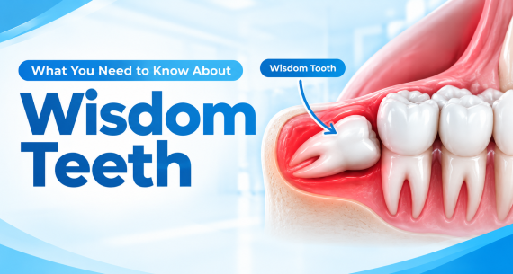 What You Need to Know About Wisdom Teeth